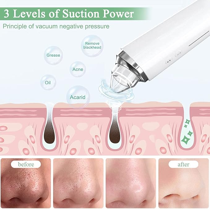 Blackhead Remover Pore Vacuum